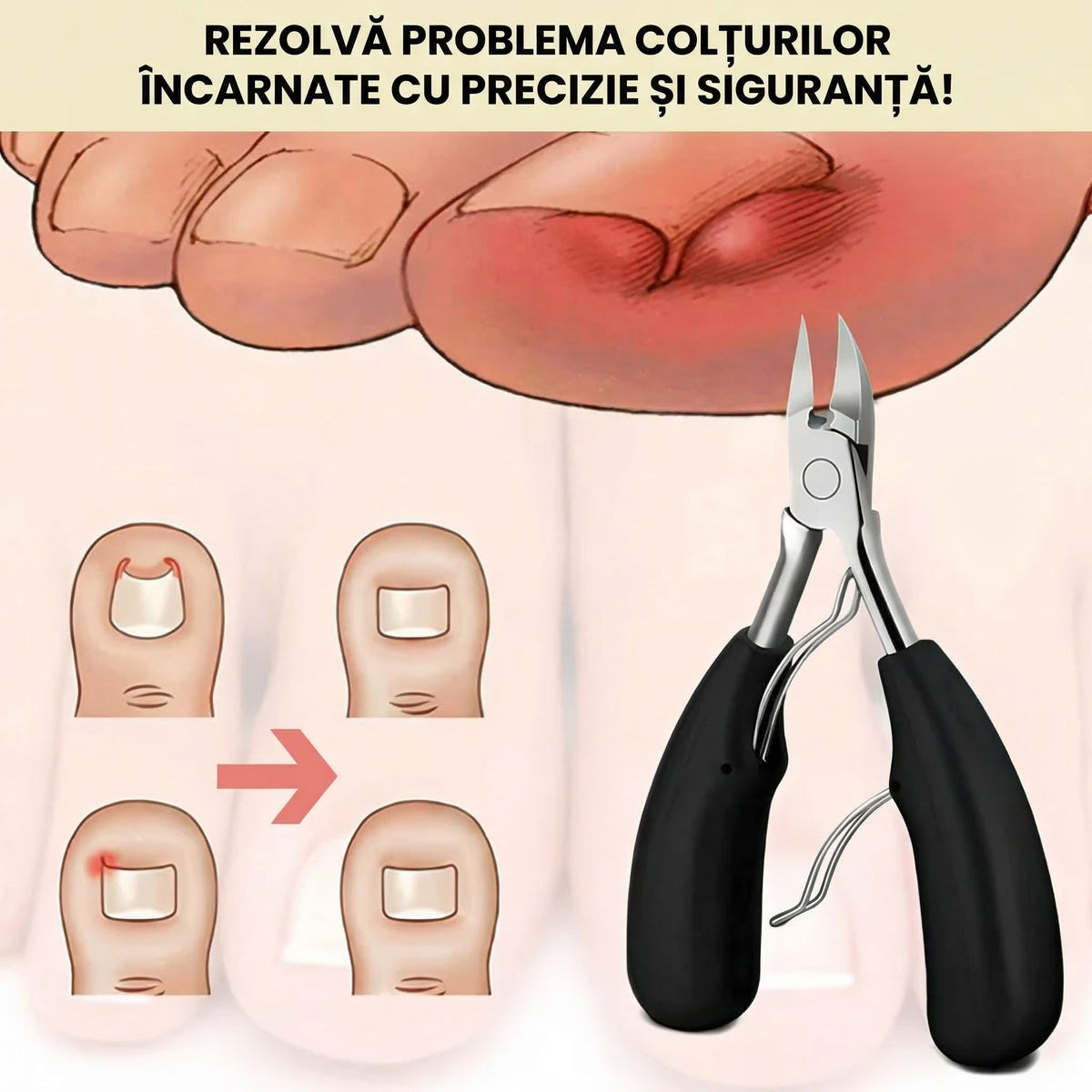Trusă pentru Unghii Groase și Încarnate – Ofertele Zilei